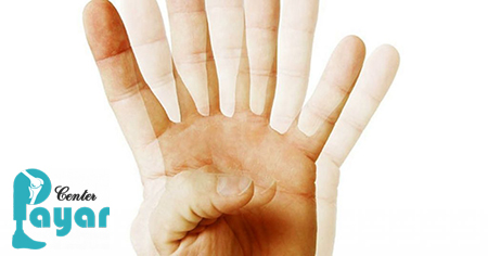 انواع اختلالات بینایی چیست