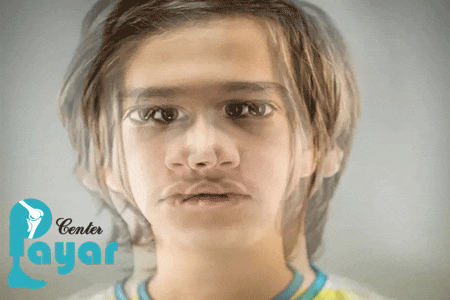 علت موج دار شدن دید چشم چیست؟ آن را جدی بگیرید