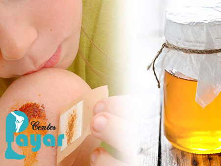 در مورد درمان قطعی زخم پای دیابتی در طب سنتی چه میدانید؟
