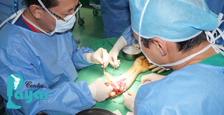 در کودکان، ایا پیوند دست امکان پذیر است؟