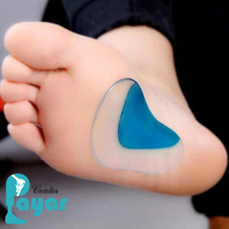 در مورد علت قوس کف پا چه میدانید؟ چرا برخی ها مجبورند برای ساخت کفش مناسب کف پای قوس دار اقدام کنند؟