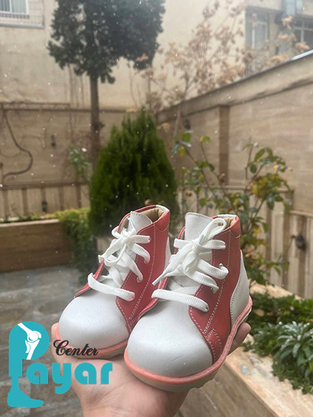 ساخت کفش برای عارضه پا چنبری یا کلاب فوت