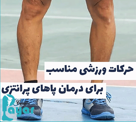 انجام حرکت های اصلاحی و درمان زانوی پرانتزی بدون جراحی