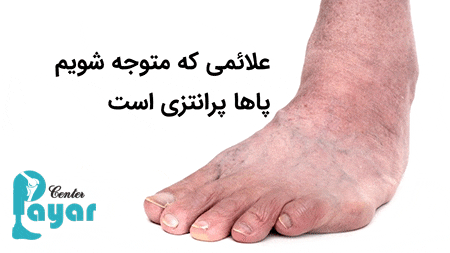 بهترین روش تشخیص زانوی پرانتزی