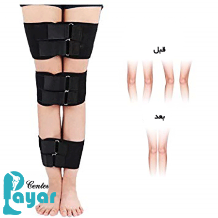 عوامل تاثیرگذار روی قیمت زانو بند برای زانوی ضربدری