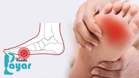 علت درد متاتارسال چیست