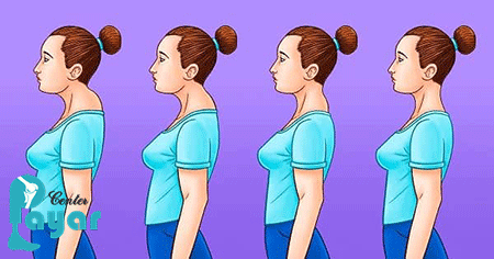 آیا میدانید قوز گردن چیست
