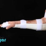قیمت خرید آتل بلند دست🌟(اسپیلنت کوکاپ)